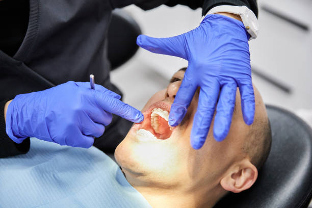 Best Teeth Whitening  in Vandalia, OH